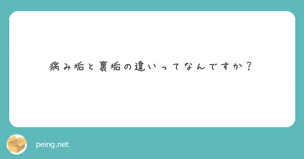 乃木坂46の齋藤飛鳥ちゃん可愛いと思いませんか Peing 質問箱 乃木坂46の齋藤飛鳥ちゃん可愛いと思いませんか Peing 質問箱