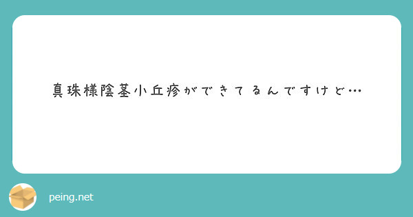 真珠様陰茎小丘疹ができてるんですけど… | Peing -質問箱-