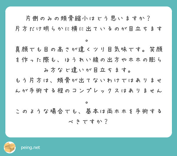 片側のみの頬骨縮小はどう思いますか 片方だけ明らかに横に出ているのが目立ちます Peing 質問箱