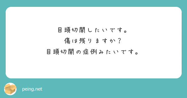 目頭切開したいです。
傷は残りますか？
目頭切開の症例みたいです。