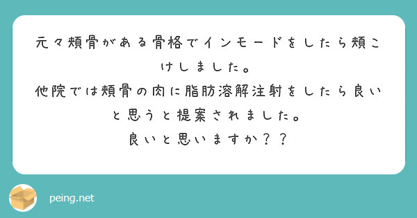 元々頬骨がある骨格でインモードをしたら頬こけしました。
他院では頬骨の肉に脂肪溶解注射をしたら良いと思うと提案されました。
良いと思いますか？？